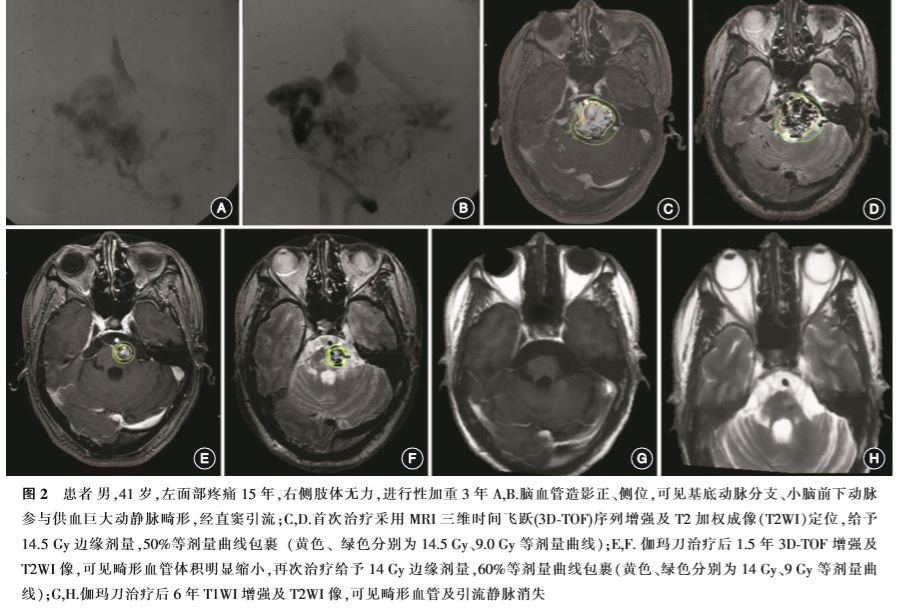 最新呕吐研究，原因、诊断与治疗方法