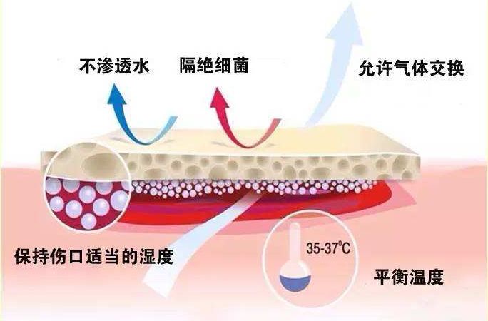 最新敷料，引领伤口愈合的革命性技术